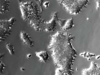 cells grown without serum