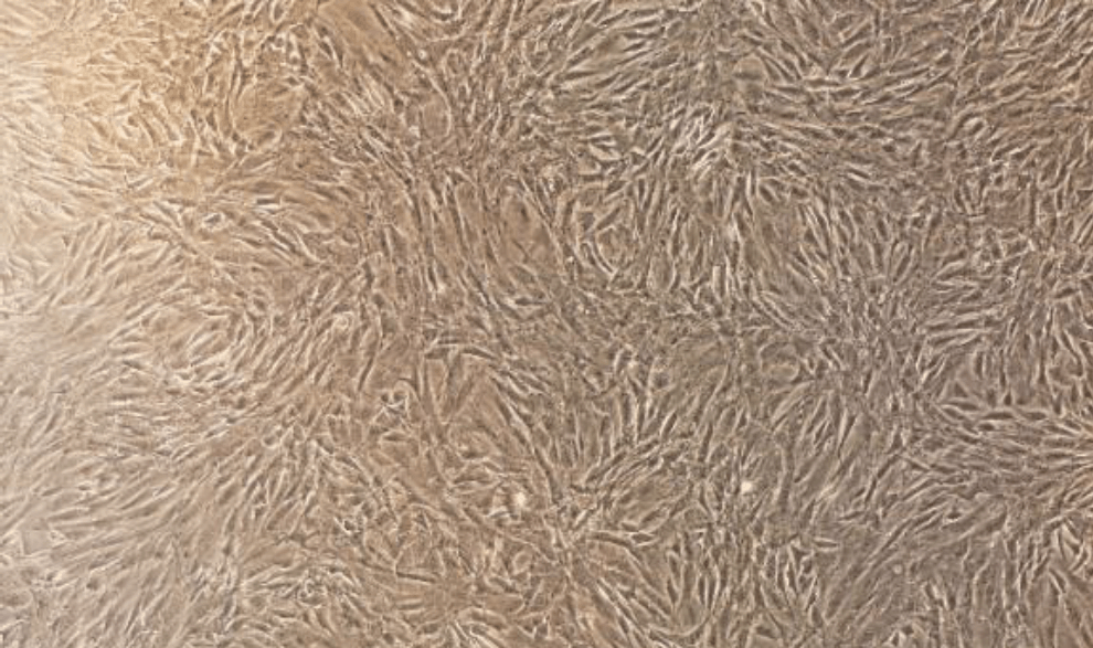 Lucy's cells, day 7, Magic Valley